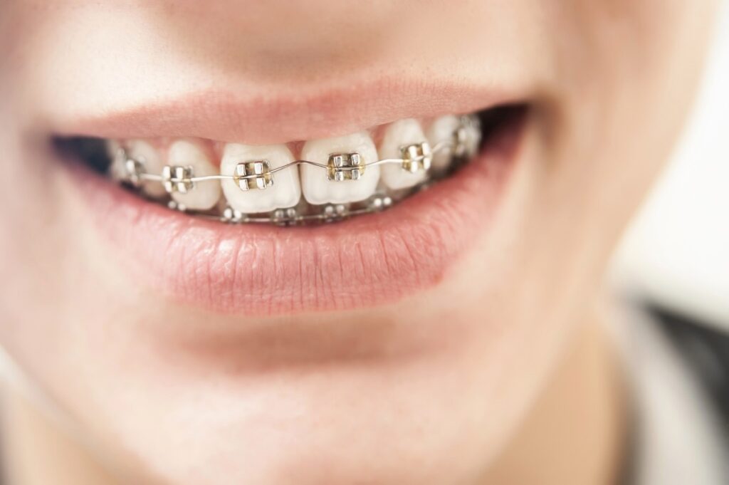 Vilanova implantes dentales